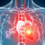 عام وائرل انفیکشن بھی ہارٹ اٹیک کا سبب بن سکتے ہیں، ماہرین کا انکشاف